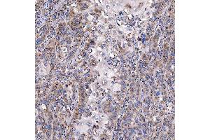 IHC analysis of TTC7B using anti-TTC7B antibody (ABIN7601050). (TTC7B Antikörper  (AA 275-730))