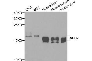 Western Blotting (WB) image for anti-Niemann-Pick Disease, Type C2 (NPC2) antibody (ABIN1876601) (NPC2 Antikörper)