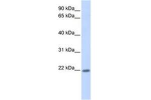ZNF534 antibody  (AA 101-150)