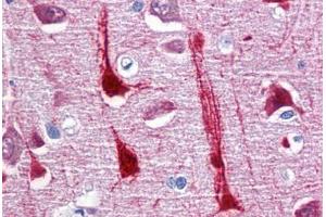 Human Brain, cortex: Formalin-Fixed, Paraffin-Embedded (FFPE) (CRYM Antikörper  (AA 215-315))