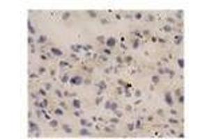 Image no. 1 for anti-Interleukin 18 (IL18) antibody (ABIN791564) (IL-18 Antikörper)