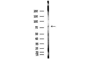 anti-Cyclin T2 (CCNT2) (Internal Region) antibody