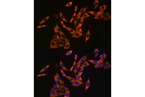 Immunofluorescence analysis of NIH/3T3 cells using UB Rabbit mAb (ABIN7271128) at dilution of 1:50 (40x lens). (UBA52 Antikörper)