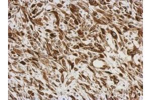 IHC-P Image Immunohistochemical analysis of paraffin-embedded C2C12 xenograft, using AGR3, antibody at 1:500 dilution. (AGR3 Antikörper  (Center))