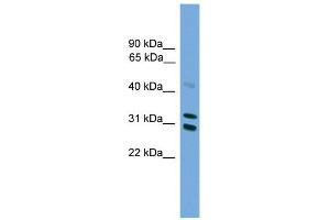 WB Suggested Anti-PSME2 Antibody Titration: 0. (PSME2 Antikörper  (Middle Region))