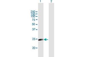 Western Blot analysis of MYLC2PL expression in transfected 293T cell line by MYLC2PL MaxPab polyclonal antibody. (MYL10 Antikörper  (AA 1-226))