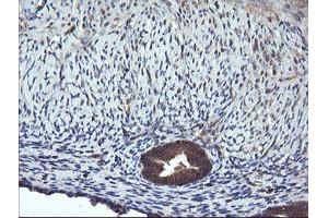 Image no. 4 for anti-Mitogen-Activated Protein Kinase Kinase 1 (MAP2K1) antibody (ABIN1499394) (MEK1 Antikörper)