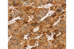 Immunohistochemistry (IHC) image for anti-Lymphotoxin beta (TNF Superfamily, Member 3) (LTB) antibody (ABIN2427427) (LTB Antikörper)
