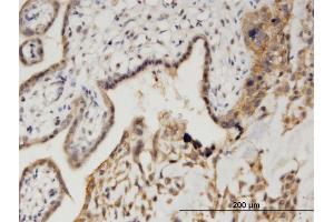 Immunoperoxidase of monoclonal antibody to CAMK1D on formalin-fixed paraffin-embedded human placenta. (CAMK1D Antikörper  (AA 1-95))