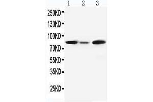 Anti-MCM5 antibody, Western blotting Lane 1: Rat Testis Tissue Lysate Lane 2: Rat Brain Tissue Lysate Lane3: JURKAT Cell Lysate (MCM5 Antikörper  (C-Term))