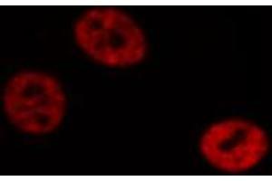 ABIN6272422 staining Hela by IF/ICC. (RTCD1 Antikörper  (C-Term))