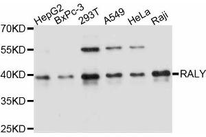 Western blot analysis of extracts of various cell lines, using RALY antibody. (Raly Antikörper  (AA 96-306))