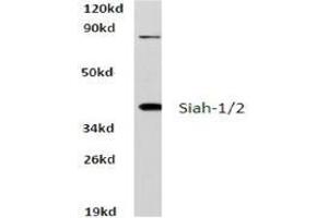 Western blot analysis of Siah-1/2 Antibody  in extracts from HeLa cells at 1/500 dilution. (SIAH1 Antikörper)