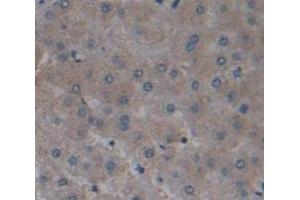 Immunohistochemistry (IHC) image for anti-Ephrin Type A Receptor 1 (EPHA1) (AA 599-842) antibody (ABIN1858727)
