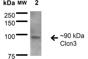 Western Blot analysis of Rat Brain Membrane showing detection of ~90 kDa CIcn3 protein using Mouse Anti-CIcn3 Monoclonal Antibody, Clone S258-5 . (CLCN3 Antikörper  (AA 98-115) (Atto 594))