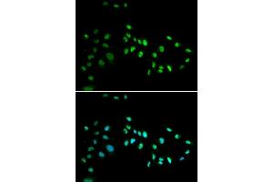 Immunofluorescence analysis of A549 cell using DNMT3A antibody. (DNMT3A Antikörper)