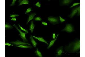 Immunofluorescence of monoclonal antibody to PURA on HeLa cell. (PURA Antikörper  (AA 183-292))