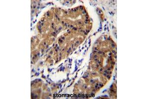 Immunohistochemistry (IHC) image for anti-Deleted in Colorectal Carcinoma (DCC) antibody (ABIN2996670) (DCC Antikörper)