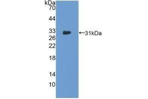 Detection of Recombinant NOSTRIN, Human using Polyclonal Antibody to Nitric Oxide Synthase Trafficker (NOSTRIN)