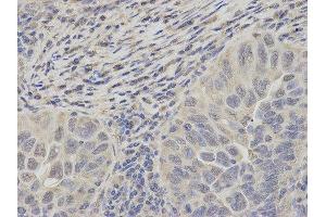 Immunohistochemistry (IHC) image for anti-Proteasome (Prosome, Macropain) 26S Subunit, ATPase, 2 (PSMC2) antibody (ABIN1874379) (PSMC2 Antikörper)