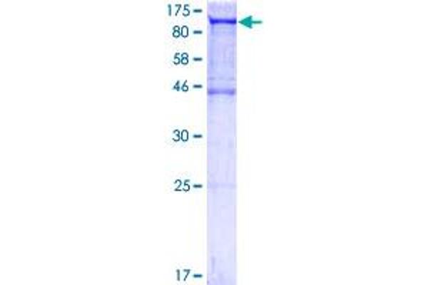 ALIX Protein (AA 1-868) (GST tag)