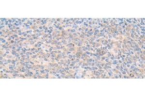 Immunohistochemistry of paraffin-embedded Human tonsil tissue using SMS Polyclonal Antibody at dilution of 1:70(x200) (SMS Antikörper)