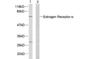 Western blot analysis of extracts from MCF7 cells using Estrogen Receptor-α (Ab-167) antibody (E021068). (Estrogen Receptor alpha Antikörper)