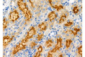 ABIN6258927 and ABIN6273927 at 1/100 staining Rat kidney tissue by IHC-P.