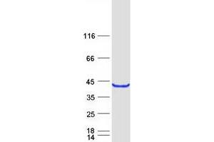 Western Blotting (WB) image for HORMA Domain Containing 2 (HORMAD2) protein (Myc-DYKDDDDK Tag) (ABIN2722969)