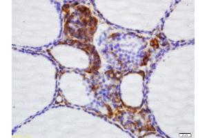 Formalin-fixed and paraffin embedded dog thyroid labeled with Rabbit Anti-NNT Polyclonal Antibody, Unconjugated (ABIN709631) at 1:200 followed by conjugation to the secondary antibody and DAB staining