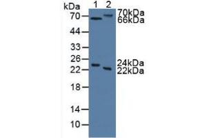 Figure. (Mannose Associated Serine Protease 2 (AA 445-683) Antikörper)