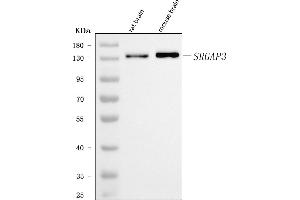Western blot analysis of SRGAP3 using anti-SRGAP3 antibody (ABIN7602538). (SRGAP3 Antikörper  (AA 824-1067))