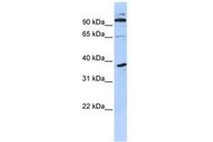 Image no. 1 for anti-PHD Finger Protein 11 (PHF11) (N-Term) antibody (ABIN6740584) (PHF11 Antikörper  (N-Term))
