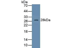 Detection of Recombinant SOCS1, Human using Polyclonal Antibody to Suppressors Of Cytokine Signaling 1 (SOCS1) (SOCS1 Antikörper  (AA 1-211))