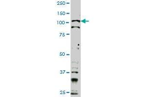 TLR9 monoclonal antibody (M02), clone 1F4 Western Blot analysis of TLR9 expression in Hela S3 NE . (TLR9 Antikörper  (AA 99-215))