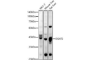 Western blot analysis of extracts of various cell lines, using DG antibody (ABIN6130268, ABIN6139559, ABIN6139561 and ABIN6218054) at 1:1000 dilution. (DGAT2 Antikörper  (AA 113-388))