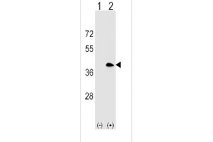 Western Blotting (WB) image for anti-Membrane-Spanning 4-Domains, Subfamily A, Member 1 (MS4A1) (AA 216-244), (C-Term) antibody (ABIN1536862)