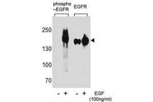Western blot analysis of extracts from A431 cells, untreated or treated with EGF using phospho-EGFR antibody (left) or nonphos Ab (right). (EGFR Antikörper  (pTyr1172))
