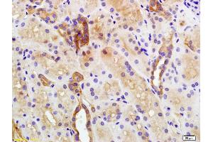 Formalin-fixed and paraffin embedded human kidney labeled with Anti-Plakophilin 2 Polyclonal Antibody, Unconjugated (ABIN1386389) at 1:200 followed by conjugation to the secondary antibody and DAB staining