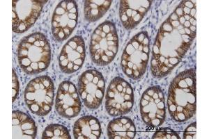 Immunoperoxidase of monoclonal antibody to CDH17 on formalin-fixed paraffin-embedded human colon. (LI Cadherin Antikörper  (AA 24-131))