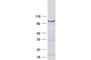 Western Blotting (WB) image for Cold Shock Domain Containing E1, RNA-Binding (CDSE1) (Transcript Variant 2) protein (Myc-DYKDDDDK Tag) (ABIN2735024)