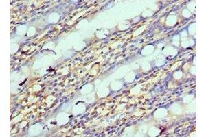 Immunohistochemistry of paraffin-embedded human colon tissue using ABIN7161635 at dilution of 1:100 (NPRL2 Antikörper  (AA 1-220))