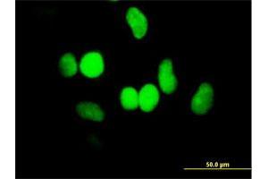 Immunofluorescence of purified MaxPab antibody to HELLS on HeLa cell. (HELLS Antikörper  (AA 1-838))