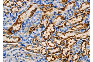 ABIN6265723 and ABIN6267021 at 1/100 staining Mouse kidney tissue by IHC-P. (TRHR Antikörper  (Internal Region))