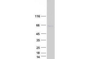 Zinc Finger, FYVE Domain Containing 19 (ZFYVE19) protein (Myc-DYKDDDDK Tag)