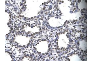 Human Lung; . (MYEF2 Antikörper  (Middle Region))