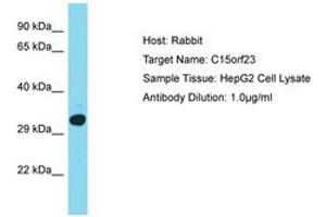 KNSTRN antibody  (AA 151-200)