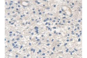 Immunohistochemistry (IHC) image for anti-Scavenger Receptor Class A, Member 5 (SCARA5) (AA 118-495) antibody (ABIN7441460)