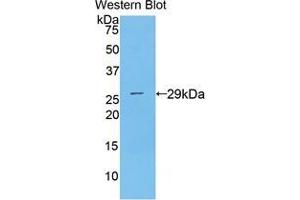 Western blot analysis of the recombinant protein. (MOK Antikörper  (AA 173-418))