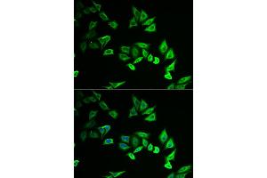 Immunofluorescence analysis of U2OS cells using MYOZ2 antibody. (MYOZ2 Antikörper)